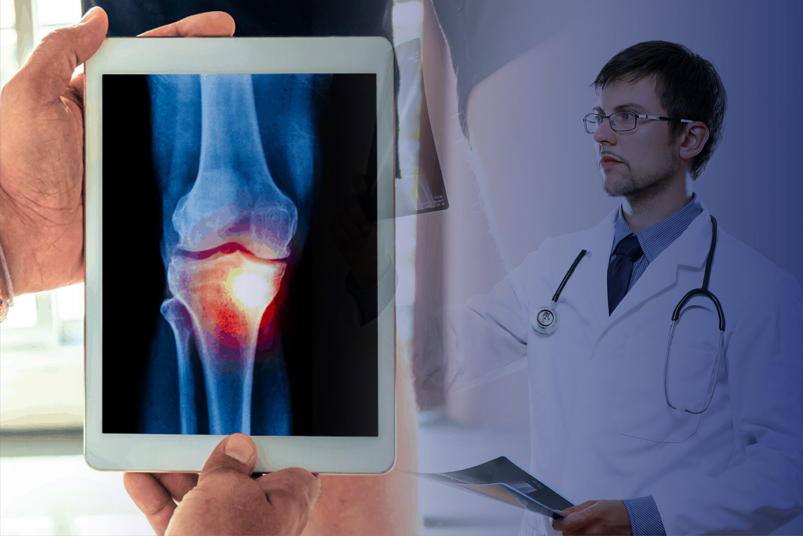 Nyeri Sendi, Harus ke Dokter Mana?